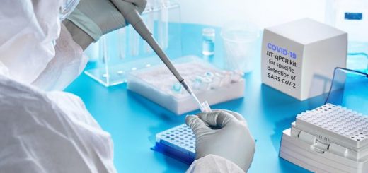 Alat pendeteksian Covid-19, RT-PCR